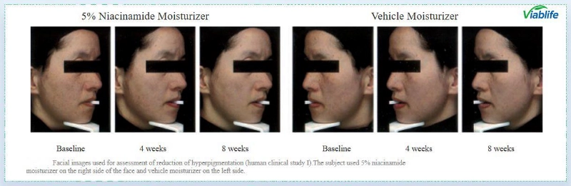 النيكوتيناميد لتفتيح البشرة Nicotinamide for Skin Brightening